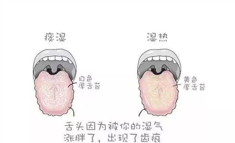 舌头上有齿痕是怎么回事（舌头边缘有齿痕怎么治）